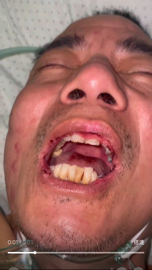 ����챻���̧����ʱ����Ƶ��ͼ